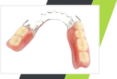 Flippers and Removable Partial Dentures Mississauga | Lifestyle Dentistry